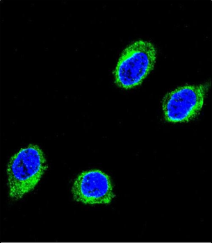 CCHCR1 Antibody (Center)