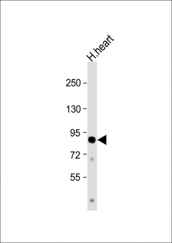 CCHCR1 Antibody (Center)