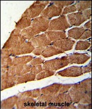 CCHCR1 Antibody (Center)