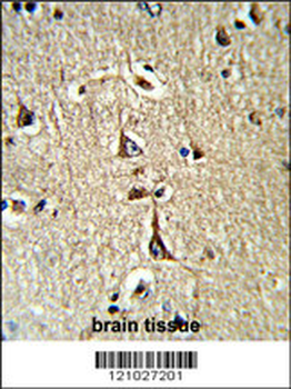 GPD1 Antibody (N-term)