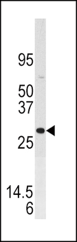 DUSP3 Antibody (N-term)