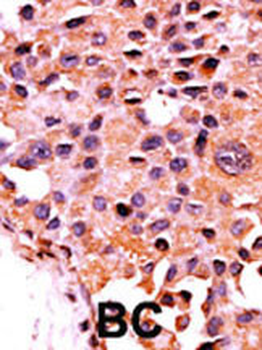 Calcineurin (PPP3CA) Antibody (N-term)