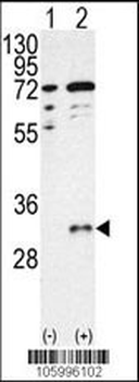 CTDSP1-V250 Antibody (C-term)