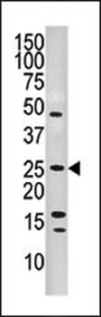 DUSP13-L184 Antibody (C-term)
