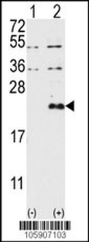 DUSP13-M1 Antibody (N-term)