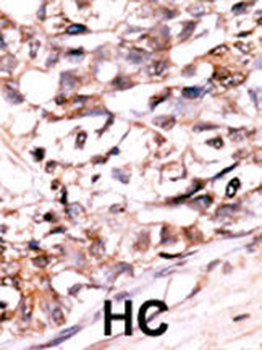 DUSP13-M1 Antibody (N-term)