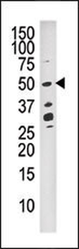 DUSP10 Antibody (N-term)