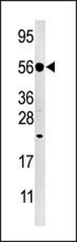 DUSP8 Antibody (C-term)