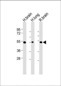 DUSP6 Antibody (Center)
