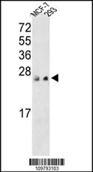 PRL3 Antibody (C-term)