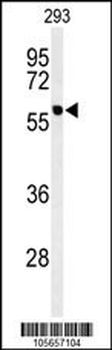 PPM1G Antibody (Center)