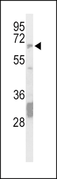 STEP / PTPN5 Antibody (N-Term)