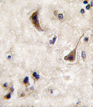 STEP / PTPN5 Antibody (N-Term)