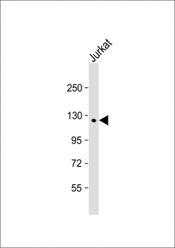 PTPD1 Antibody (Center)