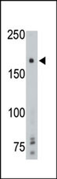 PTP gamma Antibody (Center)