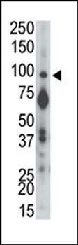 PTP alpha Antibody (N-term)