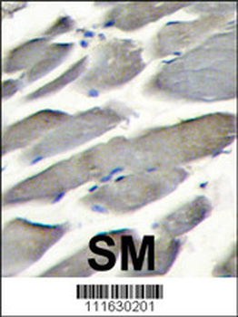 PI3KCG Antibody (Center)