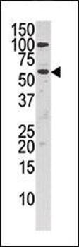 Choline kinase alpha (CHK) Antibody (C-term)
