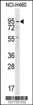 Guanylyl Cyclase alpha 2 (GUCY1A2) Antibody (C-term)