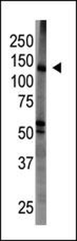 BAIAP1 (MAGI1)Antibody (C-term)