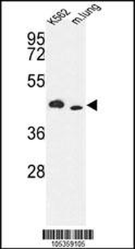 ITPKA Antibody (C-term)