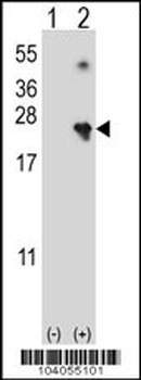 NME4 Antibody (N-term)