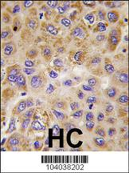 PFKFB1 Antibody (Center)