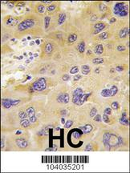 PFKFB1 Antibody (N-term)