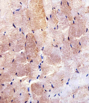 HK2 (Hexokinase II) Antibody (Center)
