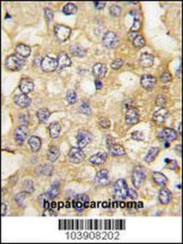 Fructose 6 Phosphate Kinase (PFKM) Antibody (C-term)