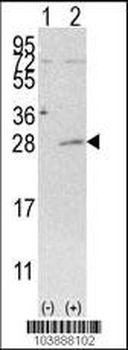AK3 Antibody (C-term H38)