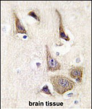AK5 Antibody (N-term)