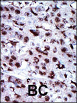 AK5 Antibody (N-term)