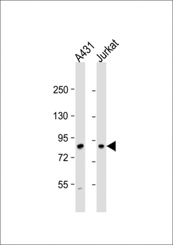 DGKA Antibody (C-term)