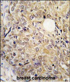 GSK3 alpha (GSK3A) Antibody (N-term)
