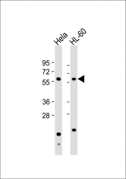 Natriuretic Peptide Receptor C Antibody (N-term)