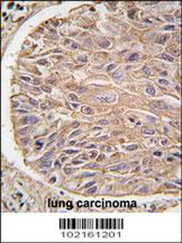 IKK beta Antibody