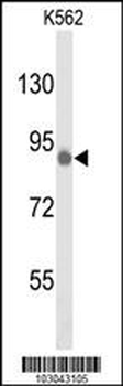 TLK1 Antibody (C-term)