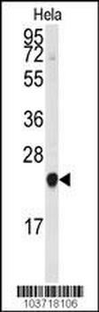 PBP Antibody (N-term)