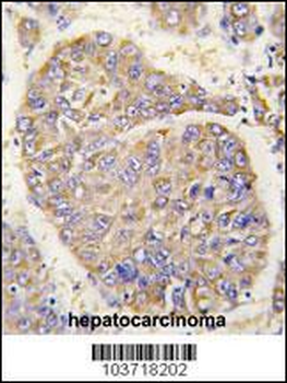 PBP Antibody (N-term)