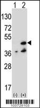 NME7 Antibody (N-term)