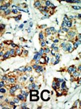 NEK4 Antibody (C-term)