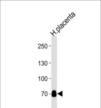 NEK11L Antibody (C-term)