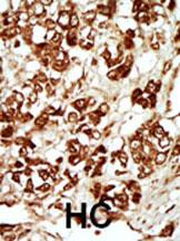 MLKLAK Antibody (Center)