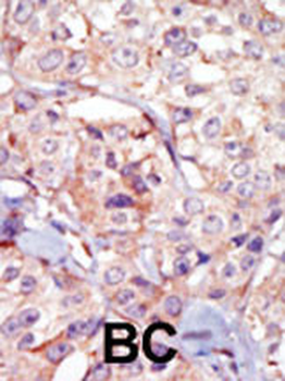GSG2 Antibody (Center)