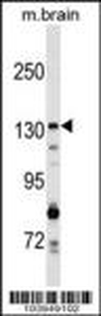 GAK Antibody (C-term)