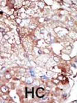 GAK Antibody (C-term)