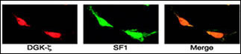 DGKZ Antibody (C-term)