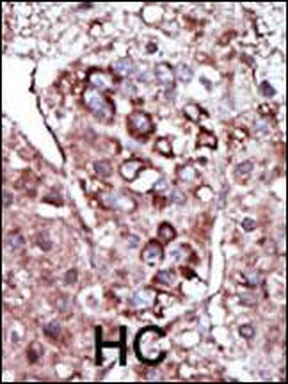 DGKZ Antibody (C-term)
