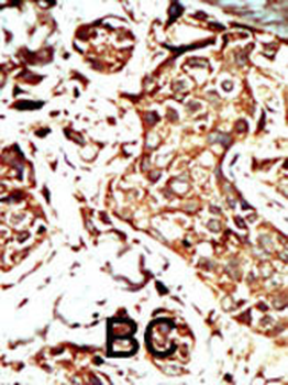 BRD3 Antibody (C-term)